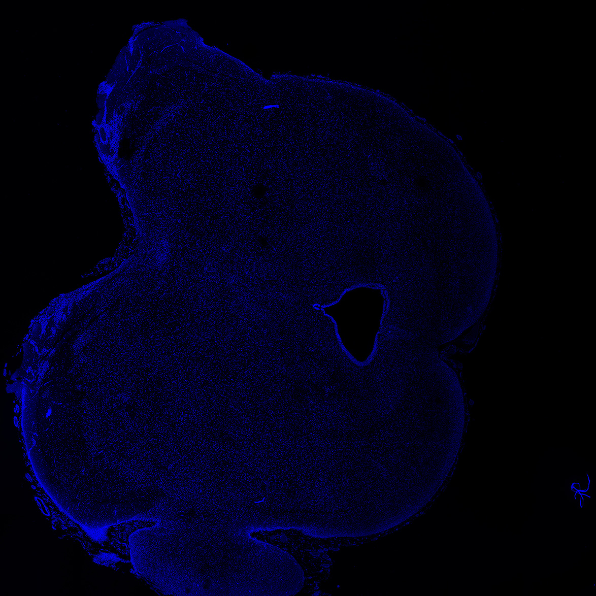Human foetal midbrain